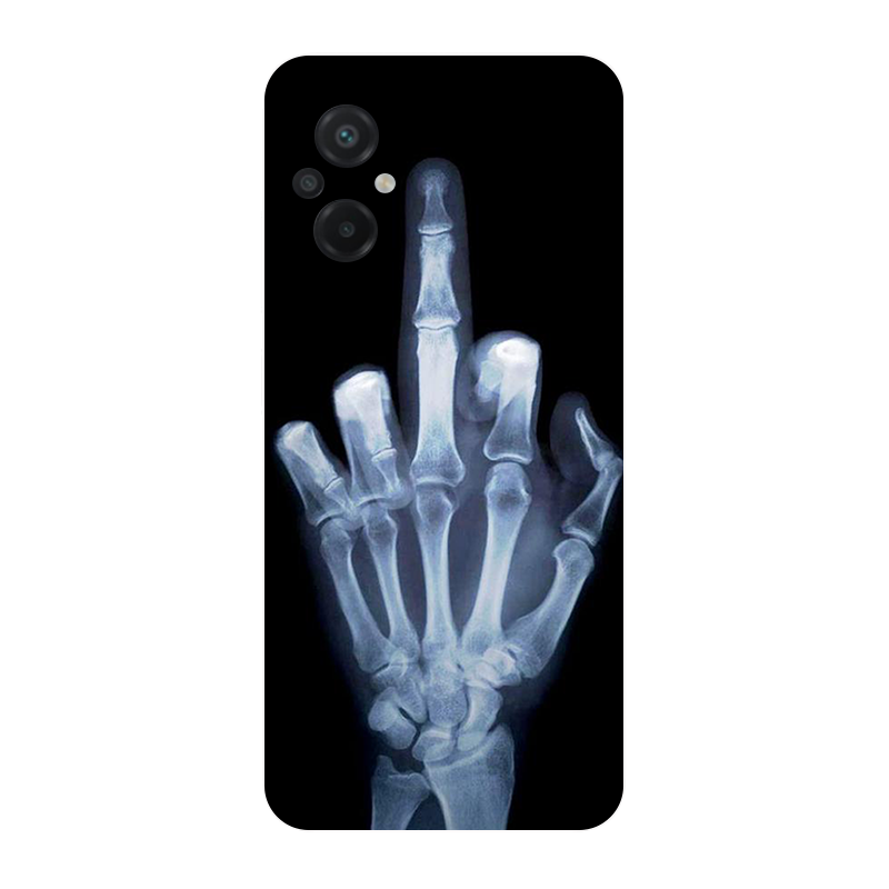 สำหรับ Poco M5 2022 4G กรณีฟุต - Phone Cases Liverpool บทวิจารณ์และราคา